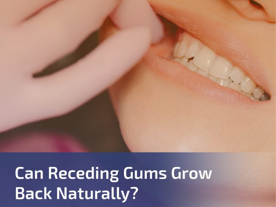 Can Receding Gums Grow Back Naturally?
