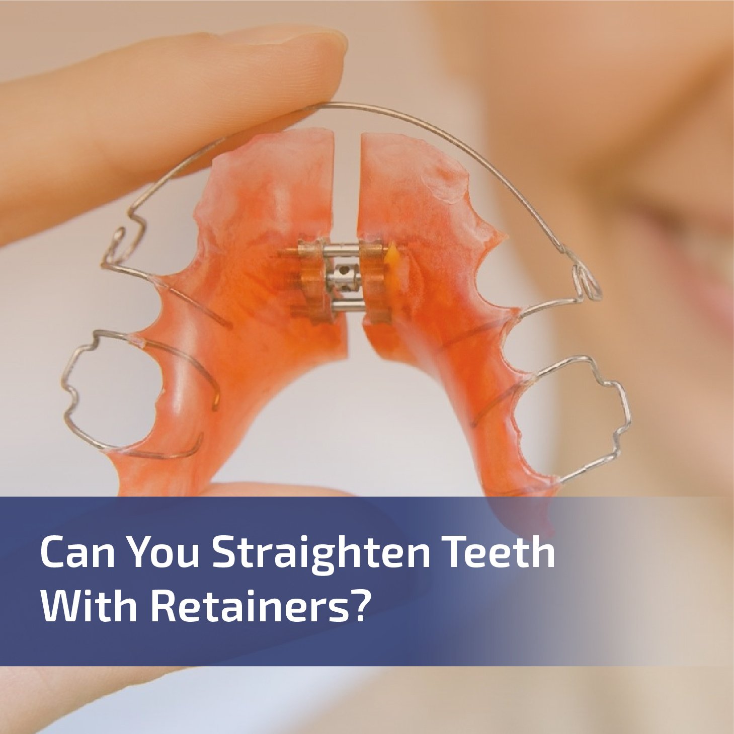 Can You Straighten Teeth with Retainers?
