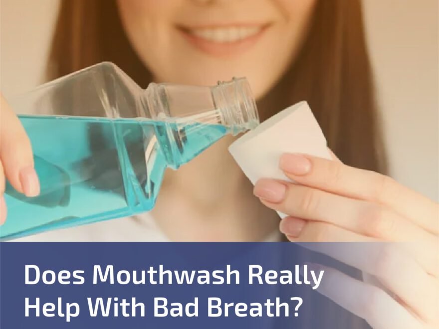 Does Mouthwash Really Help with Bad Breath?