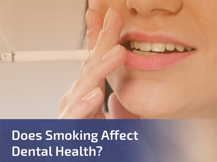 Does Smoking Affect Dental Health?