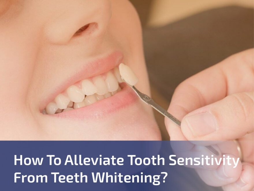 How to Alleviate Tooth Sensitivity from Teeth Whitening