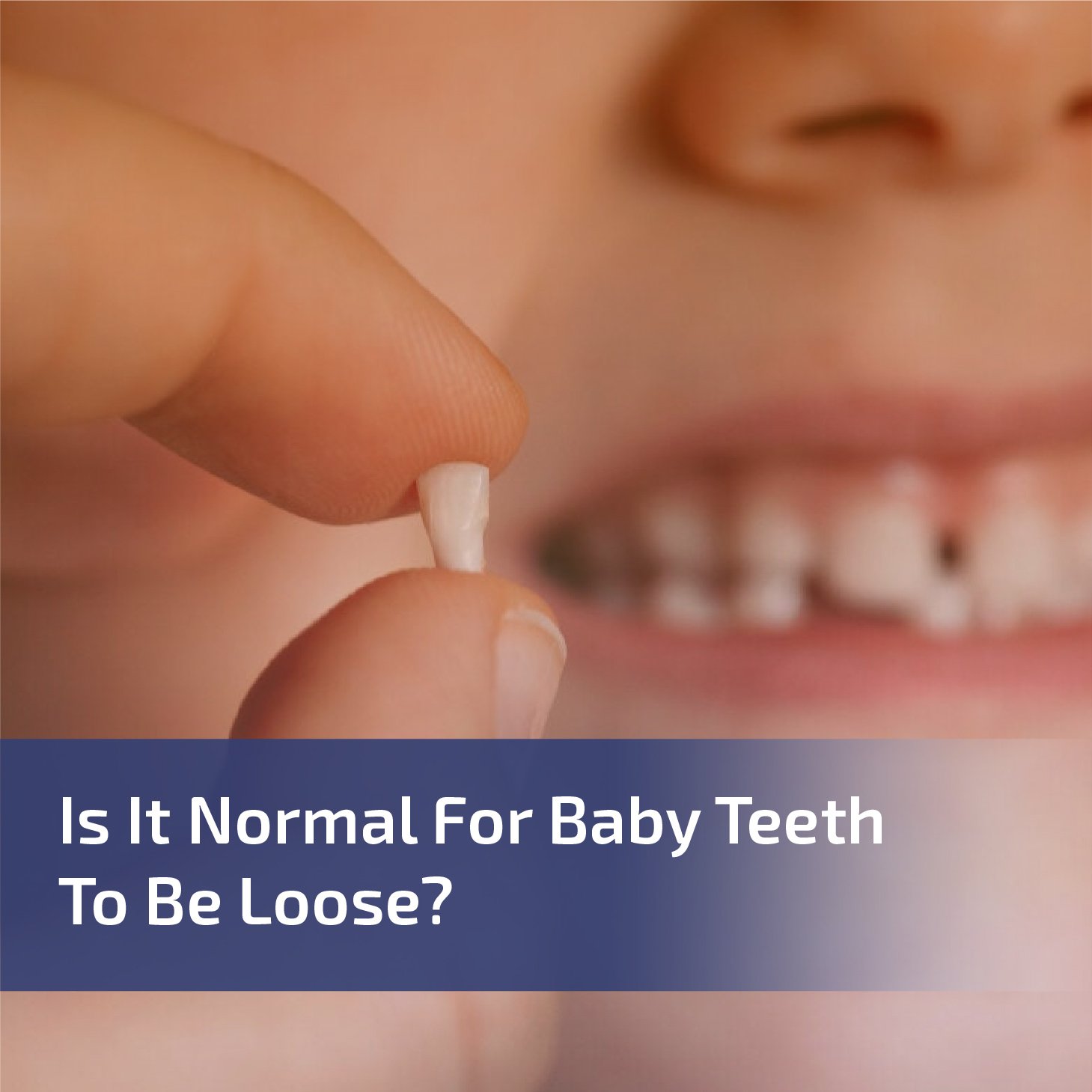 Is It Normal for Baby Teeth to Be Loose?
