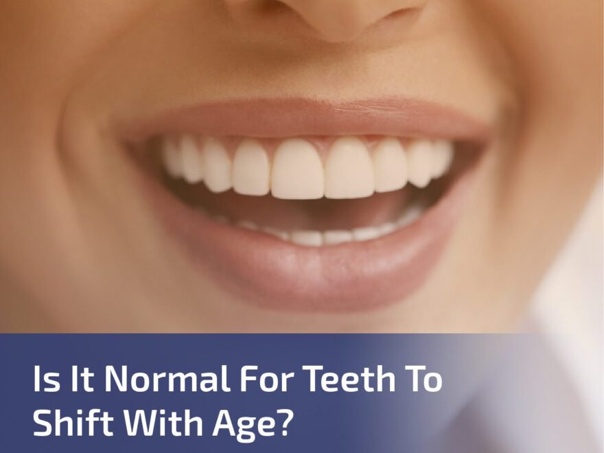 Is it Normal for Teeth to Shift With Age?