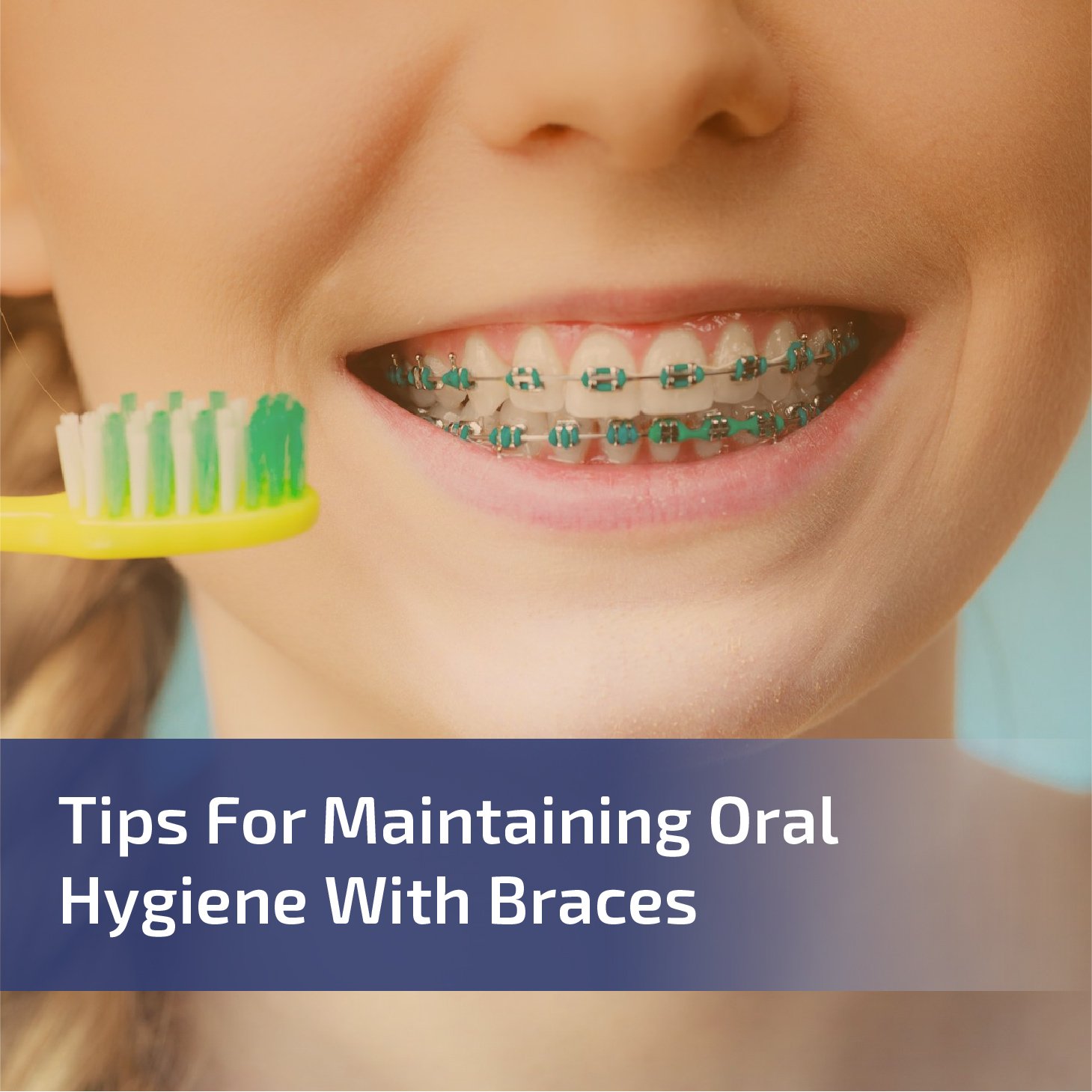 Tips for Maintaining Oral Hygiene With Braces