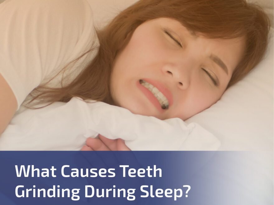 What Causes Teeth Grinding During Sleep?